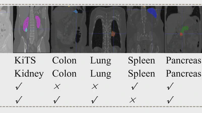 CCQ: cross-class query network for partially labeled organ segmentation featured image